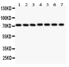 1 - Anti-SDHA Picoband Antibody ABO12123