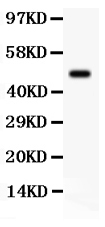 1 - Anti-SGK1 Picoband Antibody ABO12124