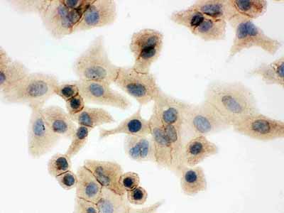 8 - Anti-SLC2A1 Picoband Antibody ABO12125