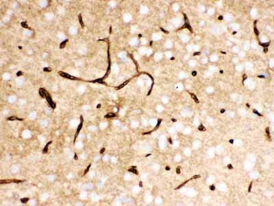 2 - Anti-SLC2A1 Picoband Antibody ABO12125