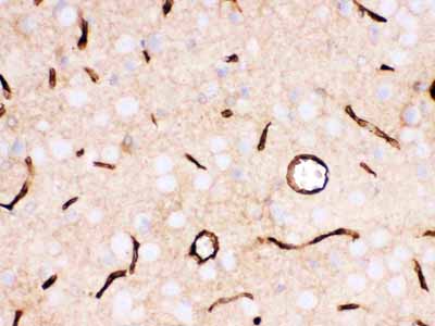 2 - Anti-SLC2A1 Picoband Antibody ABO12125