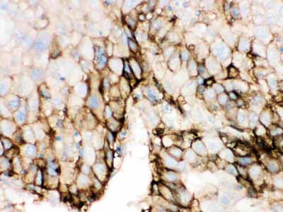 2 - Anti-SLC2A2 Picoband Antibody ABO12126