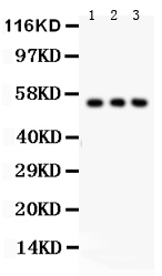 1 - Anti-SLC2A2 Picoband Antibody ABO12126