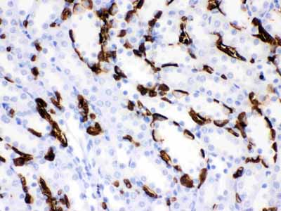 2 - Anti-Band 3 Picoband Antibody ABO12127