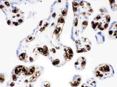 2 - Anti-Band 3 Picoband Antibody ABO12127