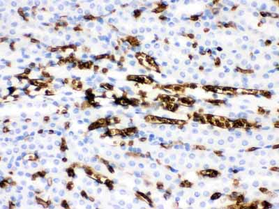 2 - Anti-Band 3 Picoband Antibody ABO12127