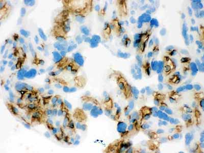 2 - Anti-Band 3 Picoband Antibody ABO12127