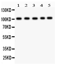 1 - Anti-Band 3 Picoband Antibody ABO12127