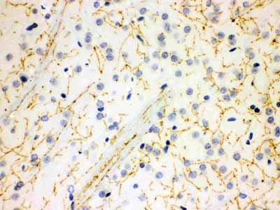 2 - Anti-SLC6A4 Picoband Antibody ABO12128