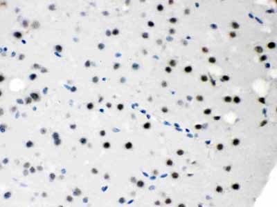 2 - Anti-SNRPN Picoband Antibody ABO12131