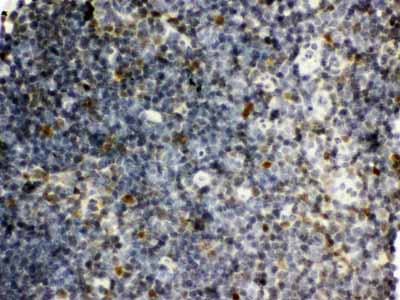 2 - Anti-SNRPN Picoband Antibody ABO12131