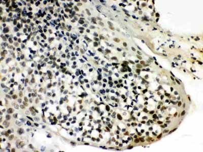 2 - Anti-SNRPN Picoband Antibody ABO12131