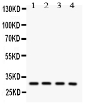 1 - Anti-SNRPN Picoband Antibody ABO12131