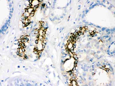 2 - Anti-SOD2 Picoband Antibody ABO12132
