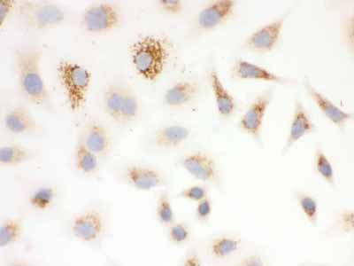 2 - Anti-SOD2 Picoband Antibody ABO12132