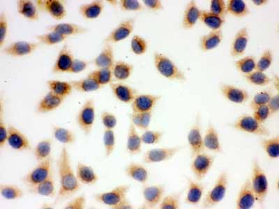 2 - Anti-SOD2 Picoband Antibody ABO12132