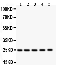 1 - Anti-SOD2 Picoband Antibody ABO12132