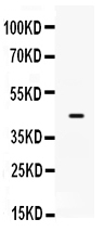 1 - Anti-Sp5 Picoband Antibody ABO12133