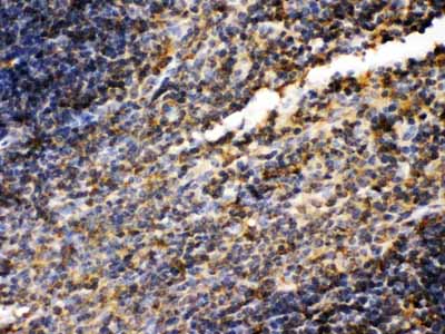 2 - Anti-TGM2 Picoband Antibody ABO12137
