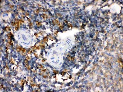 2 - Anti-TGM2 Picoband Antibody ABO12137