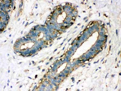 2 - Anti-TGM2 Picoband Antibody ABO12137