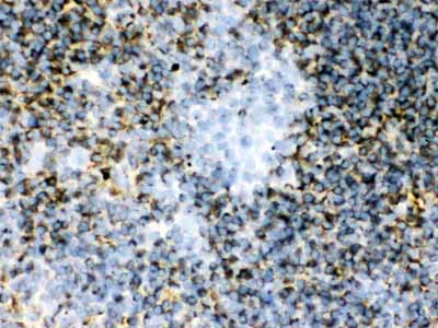 2 - Anti-TGM2 Picoband Antibody ABO12137