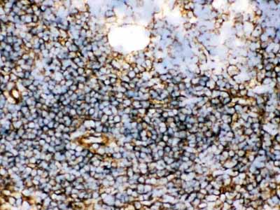 2 - Anti-TGM2 Picoband Antibody ABO12137