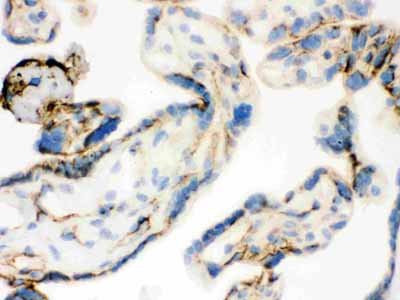 2 - Anti-TGM2 Picoband Antibody ABO12137