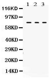 1 - Anti-TGM2 Picoband Antibody ABO12137