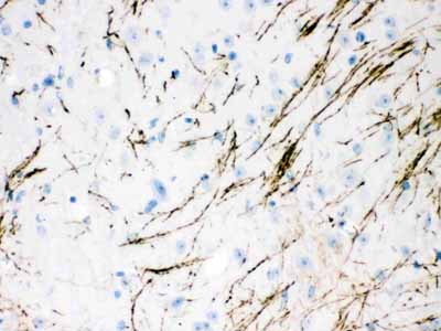 2 - Anti-Tyrosine Hydroxylase Picoband Antibody ABO12138