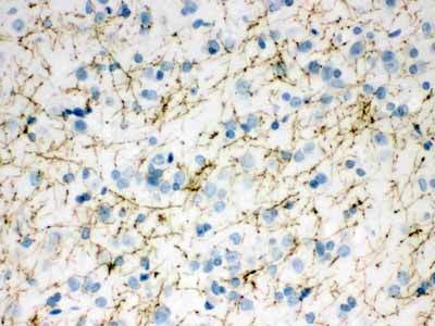 2 - Anti-Tyrosine Hydroxylase Picoband Antibody ABO12138