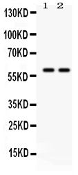 1 - Anti-Tyrosine Hydroxylase Picoband Antibody ABO12138