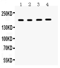 1 - Anti-THBS1/TSP1 Antibody ABO12139