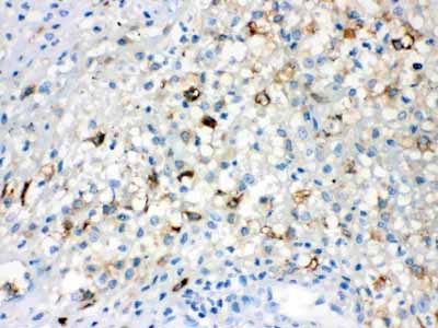 2 - Anti-TLR5 Picoband Antibody ABO12140
