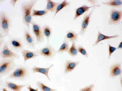 8 - Anti-TLR7 Picoband Antibody ABO12141