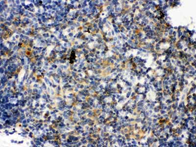 2 - Anti-TLR7 Picoband Antibody ABO12141