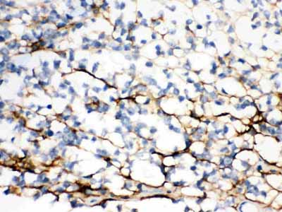 2 - Anti-Versican Picoband Antibody ABO12142
