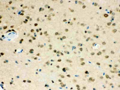 2 - Anti-VCP Picoband Antibody ABO12143