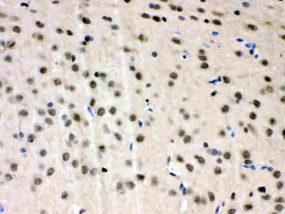 2 - Anti-VCP Picoband Antibody ABO12143