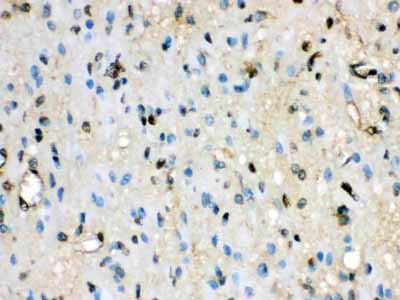 2 - Anti-VCP Picoband Antibody ABO12143