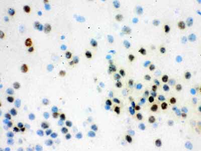 2 - Anti-VCP Picoband Antibody ABO12143