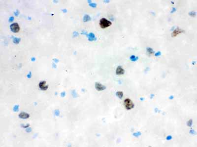 2 - Anti-VCP Picoband Antibody ABO12143