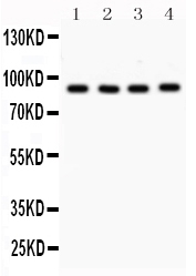 1 - Anti-VCP Picoband Antibody ABO12143