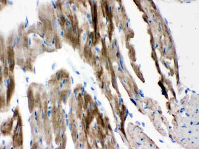 2 - Anti-VDAC/Porin Picoband Antibody ABO12144