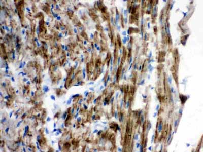 2 - Anti-VDAC/Porin Picoband Antibody ABO12144