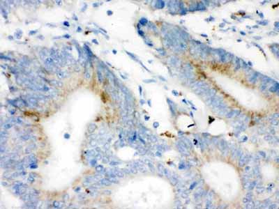 2 - Anti-VDAC/Porin Picoband Antibody ABO12144