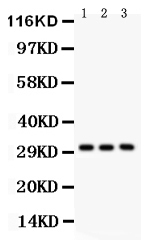 1 - Anti-VDAC/Porin Picoband Antibody ABO12144