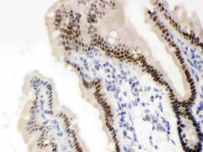 2 - Anti-VDR Picoband Antibody ABO12145