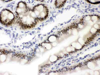 2 - Anti-VDR Picoband Antibody ABO12145