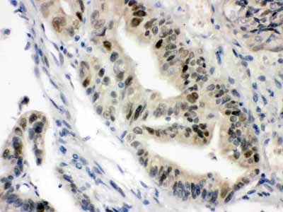 2 - Anti-VDR Picoband Antibody ABO12145
